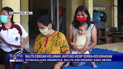 Miris! Ditinggalkan Orangtua, Balita Kelainan Jantung Kini Dirawat Sang Nenek