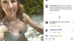 Ellie Scalding: Ellie Goulding burnt her boobs on holiday