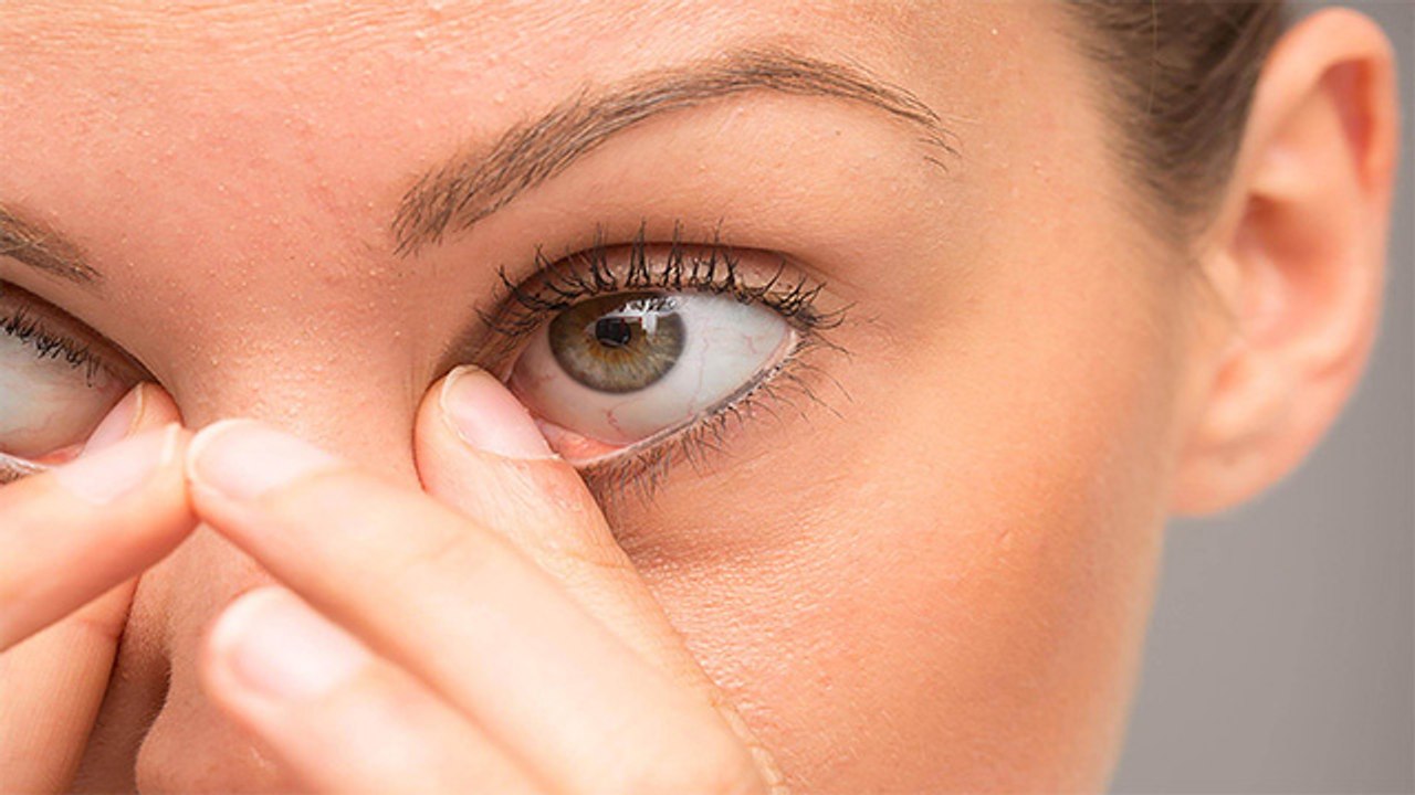 Eye Itching Home Remedy: आंखों में खुजली हो तो...
