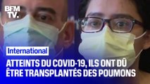 Gravement atteints du Covid-19, ils doivent leur survie à une transplantation des poumons