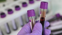 New Blood Test Can Identify Alzheimer’s Disease