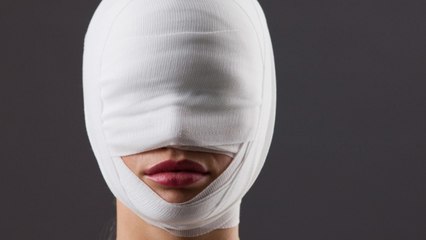 The First Woman In America To Receive A Face Transplant Has Died