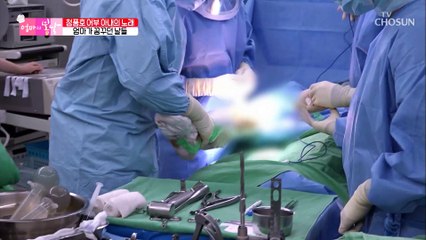 (걱정) 엄마의 무릎 수술.. 과연 결과는??