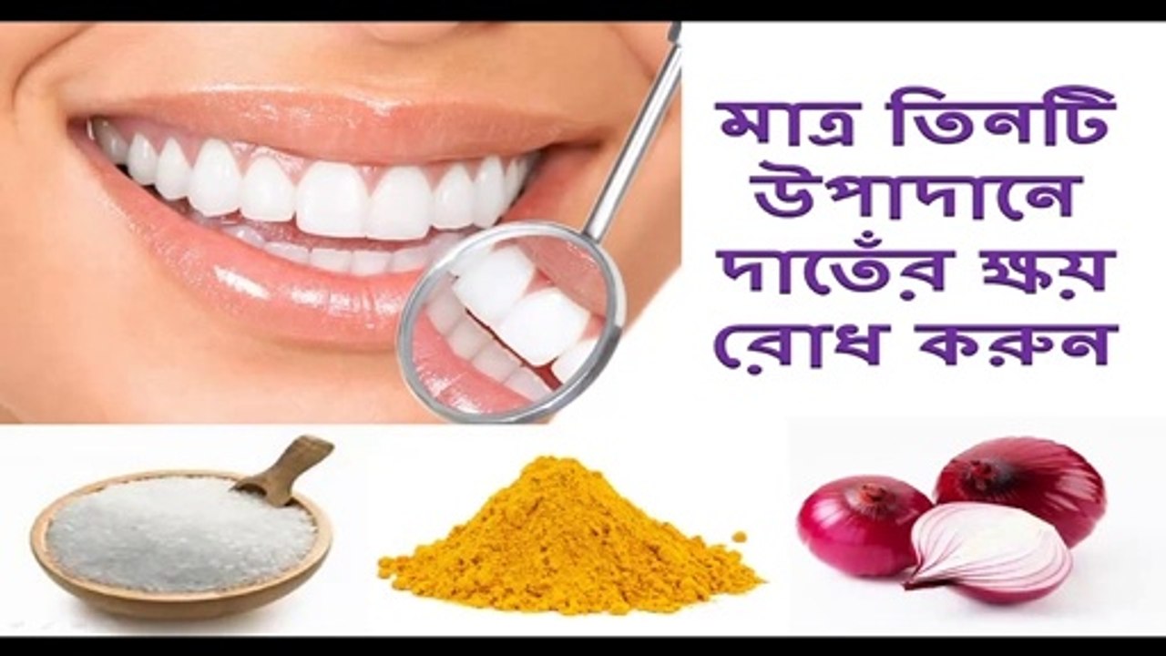 3 Steps to Get Rid of Tooth Decay Naturally ।। Tooth decay ।। How To Heal Tooth Decay ।। health tips