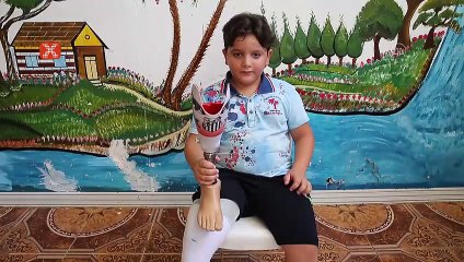 Protez bacağına Santos arması işleyen Suriyeli Hamis'e teşekkür mesajı