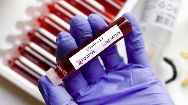 2 crore Covid-19 tests have been conducted so far: Health ministry