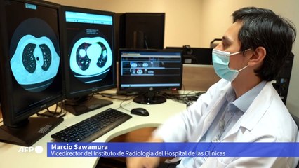 Inteligencia artificial ayuda a diagnosticar covid-19 en Brasil