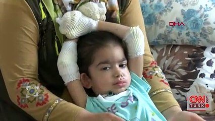 Adana'da Kelebek hastası Büşra yardım bekliyor | Video