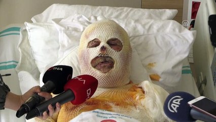 Çay yapmak için sobayı benzinle tutuşturan kişi yandı - ERZURUM