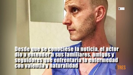 El impactante video con el que Dani Rovira visibiliza sus sesiones de radioterapia