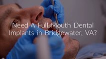 Full Mouth Dental Implants : Smiles for Life Dental Care