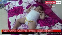 طفل سوري يخضع خلال عام ونصف لـ 21 عملية جراحية في تركيا