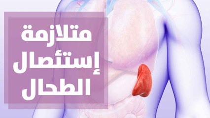 ماذا يحدث لجسمك بعد استئصال الطحال ؟ التفاصيل مع د.نغم القرة غولي