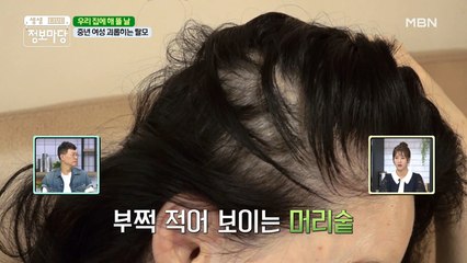 탈모에 피부 트러블까지! 중년 여성 괴롭히는 고민들