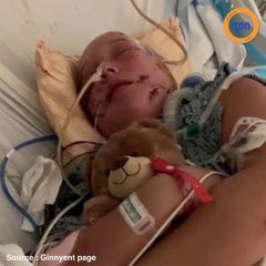 Deux pitbulls lui sautent dessus, elle est défigurée à 15 ans et se bat pour survivre