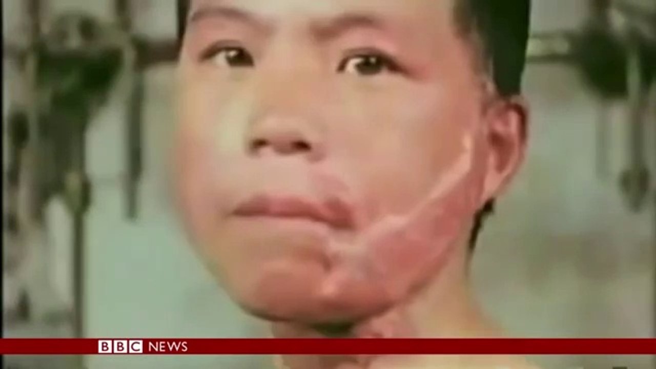 Hiroshima 75th anniversary:Hiroshima atomic bomb Survivor recalls horrors - BBC News