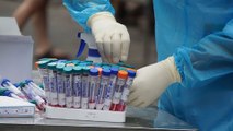 Bộ Y tế cho phép trộn mẫu xét nghiệm SARS-CoV-2