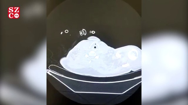 Bakan Koca, COVID-19'in etkisini aşama aşama gösterdi