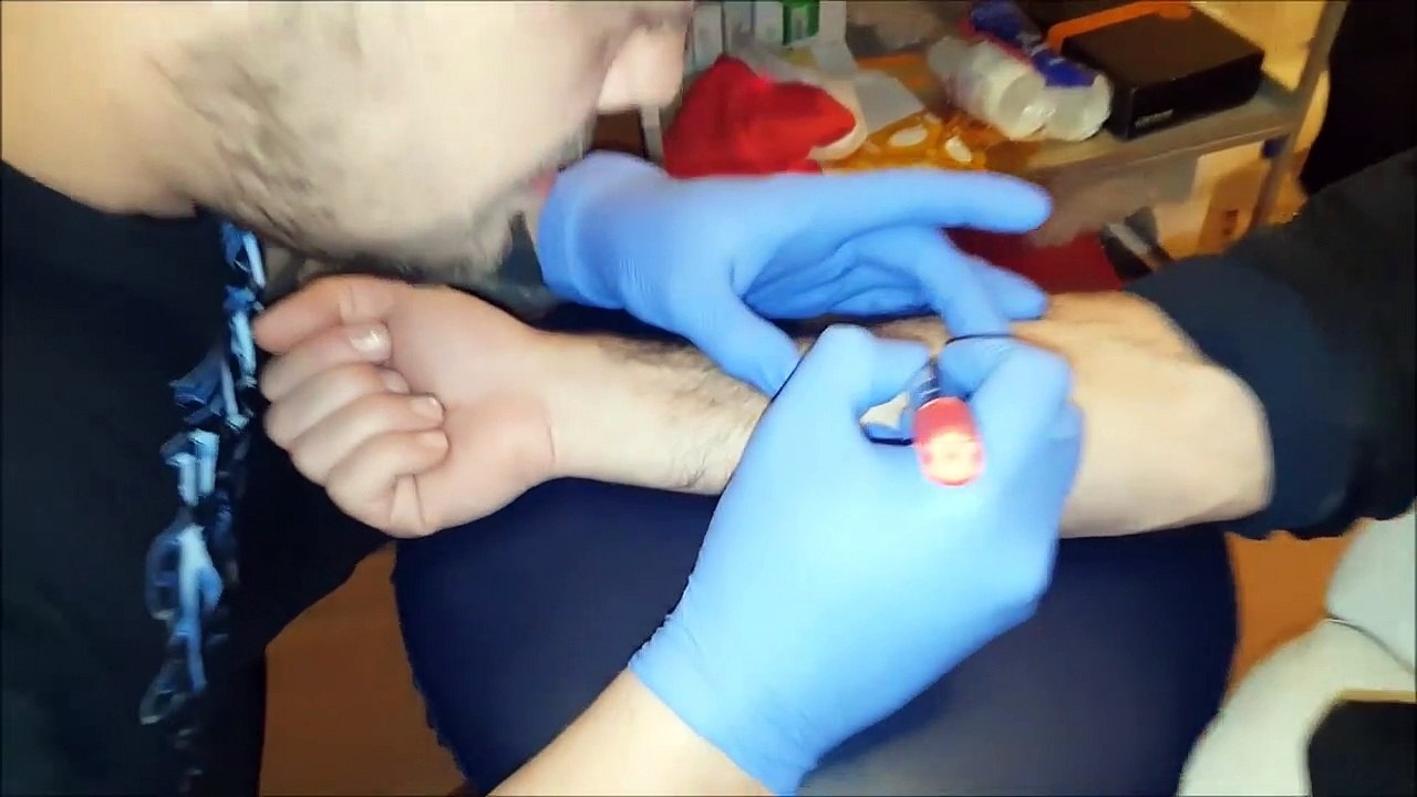 TETOVAZA