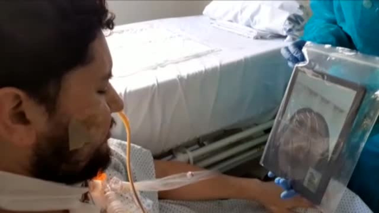 Los jóvenes no son inmunes: algunos sufren los efectos más graves del virus