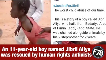 F78News: Moment epileptic boy chained for two years alongside animals is rescued, in Kebbi States Nigeria.