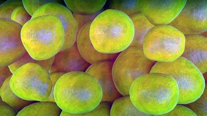 Fett Weg Spritze Frankfurt