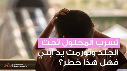 تسرب المحلول تحت الجلد وتورمت يد ابني فهل هذا خطر؟