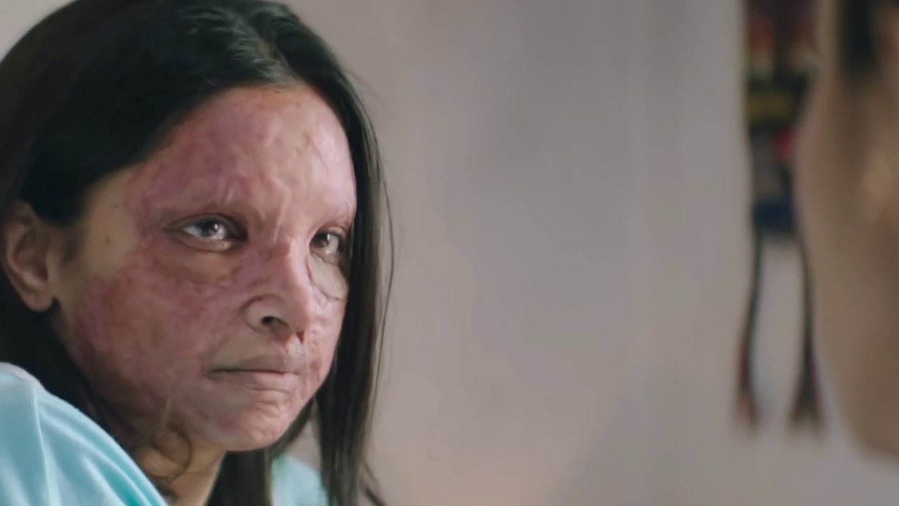 Chhapaak _ Official Trailer _ Deepika Padukone _ Vikrant Massey _ Meghna Gulzar