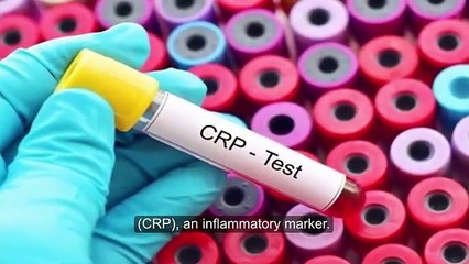 Ginger and turmeric  benefits