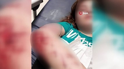 Ağabeyinin darp ettiği üniversiteli Ceylan, kendini ikinci kattan attı