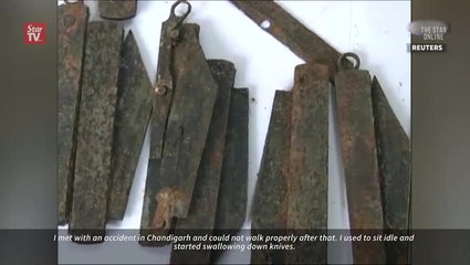 40 knives removed from man's stomach in India