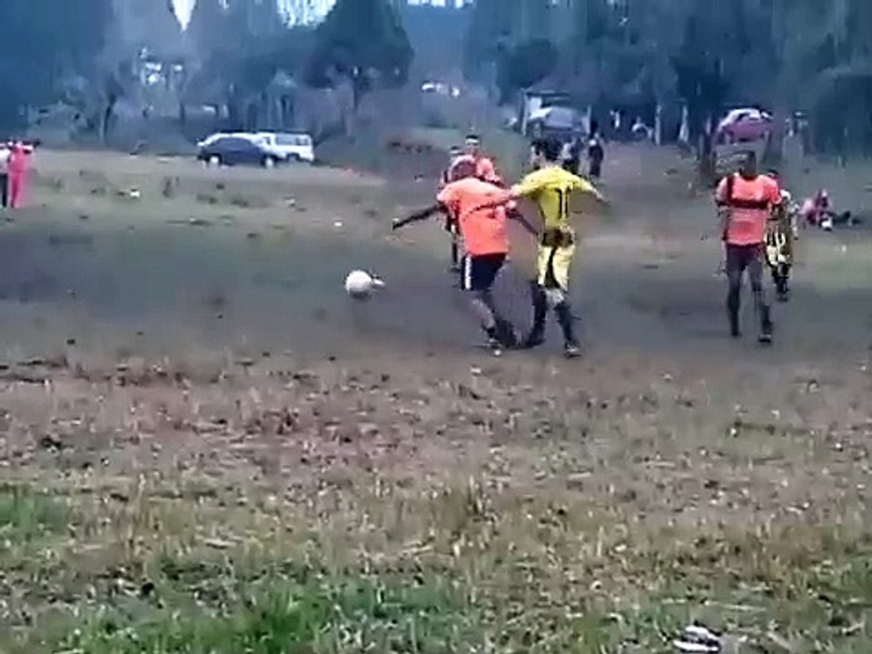 Les joies du foot amateur... mal aux tibias