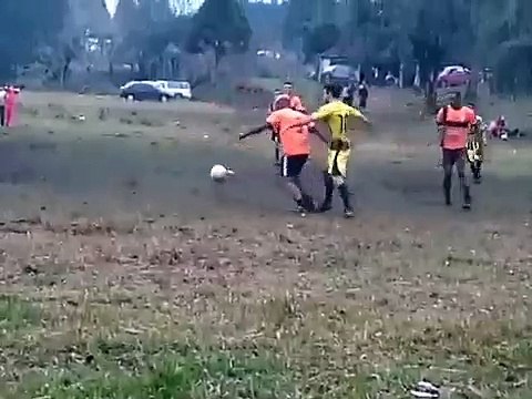 Les joies du foot amateur... mal aux tibias