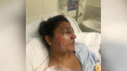 London acid attack: Police arrests 16-year-old teen