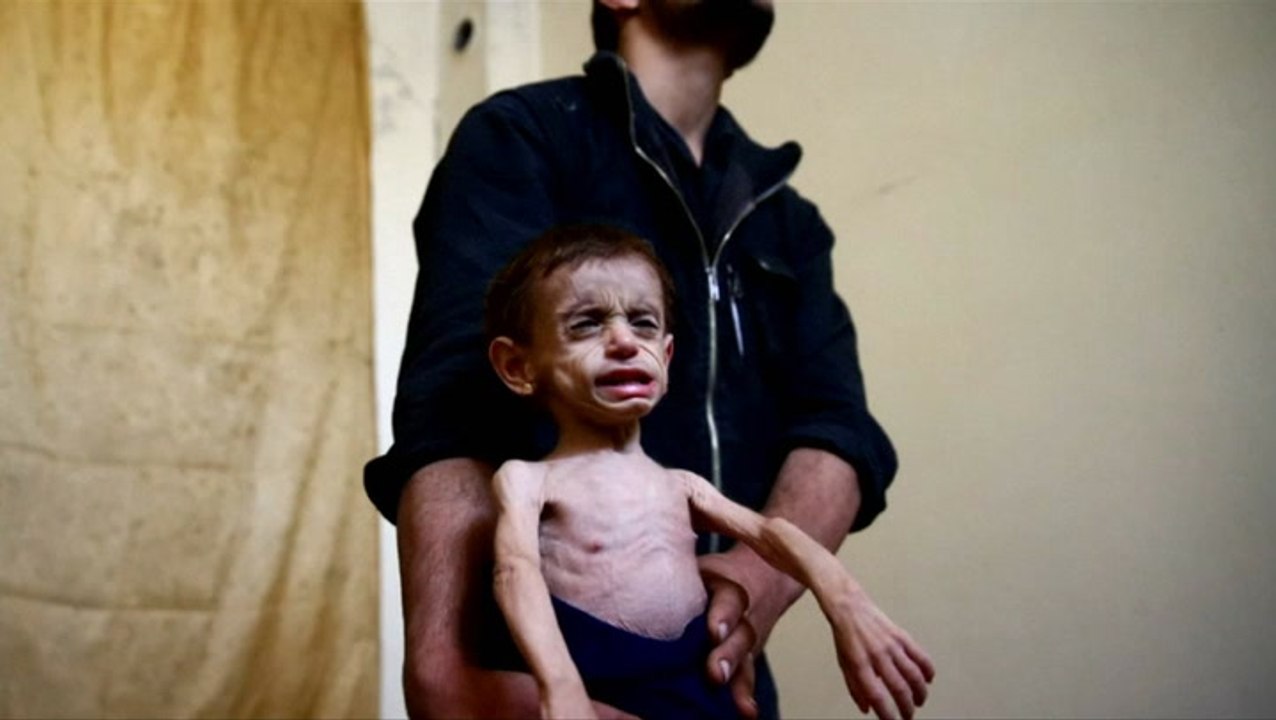 Critical patients evacuated from Syria's Ghouta