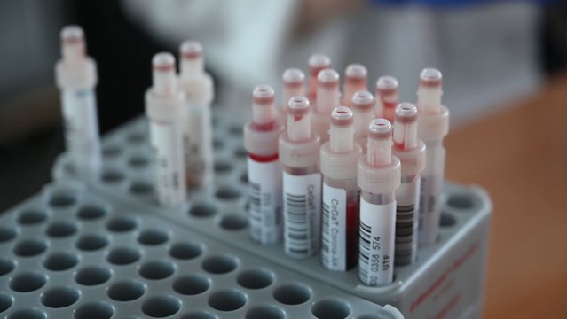 El coronavirus supera los 21 millones de contagios a nivel global