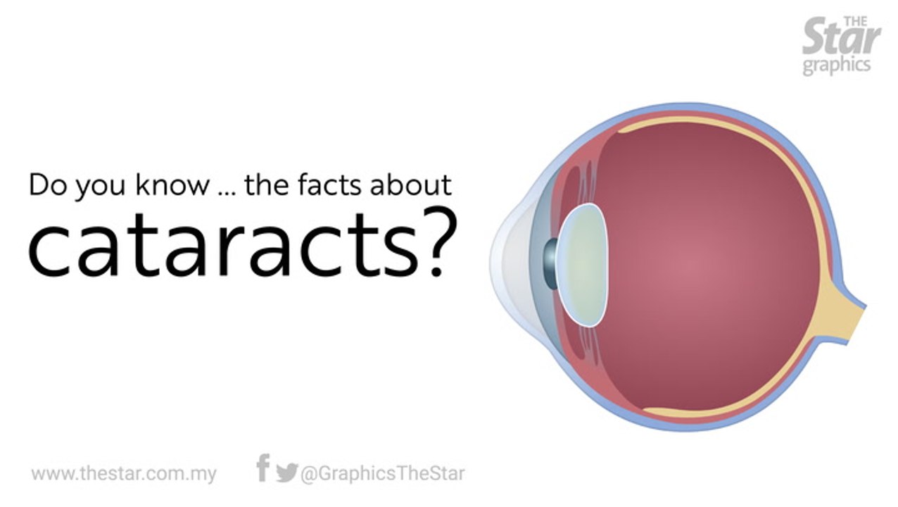 Do you know...the facts about cataract?
