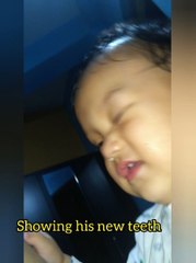 Eight months born baby survive in NICU survivor and real hero