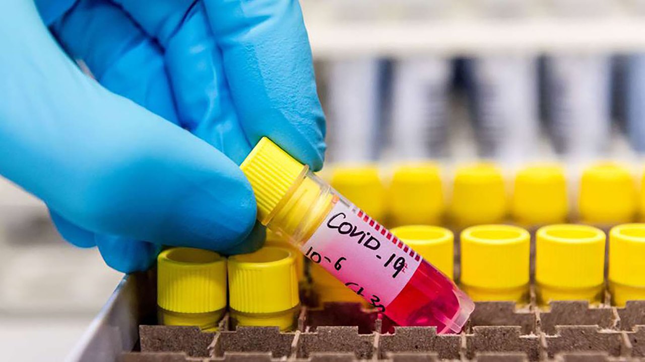 Malaysia: Biến chủng virus SARS-CoV-2 khả năng lây nhiễm gấp 10 lần
