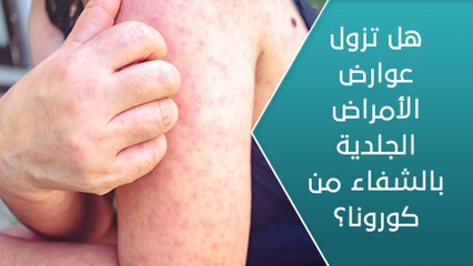 هل تزول عوارض الأمراض الجلدية بالشفاء من كورونا؟ - العيادة