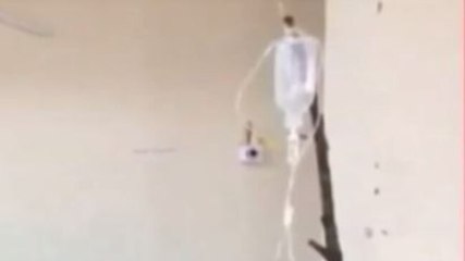 Watch: Sticks being used as fluid stands in Hyderabad's Osmania Hospital