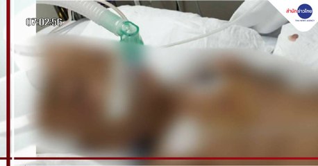 สลด! เด็กชาย 4 ขวบ ถูกแม่-พ่อเลี้ยงทำร้ายสาหัส