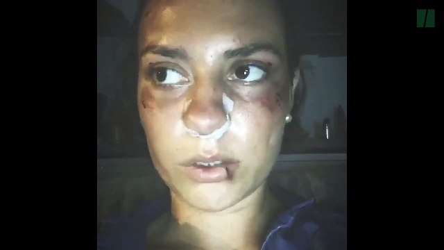 Nîmes: agressée en plein centre-ville, elle ne veut plus avoir honte