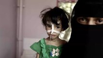 جوع وأوبئة.. حملة كبرى لإنقاذ الملايين في اليمن