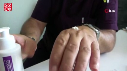 "Aşırı dezenfektan kullanımı egzamaya yol açıyor"