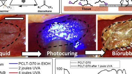 New 'Biorubber' Glue Helps Speed Up Surgical Recoveries and Pain Relief