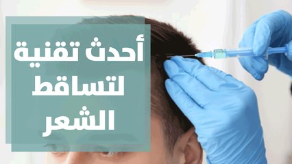 ريجينيرا..أحدث تقنية لتساقط الشعر