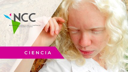 Los “hijos de la luna”: una cosmovisión de los pueblos originarios de Panamá sobre el albinismo