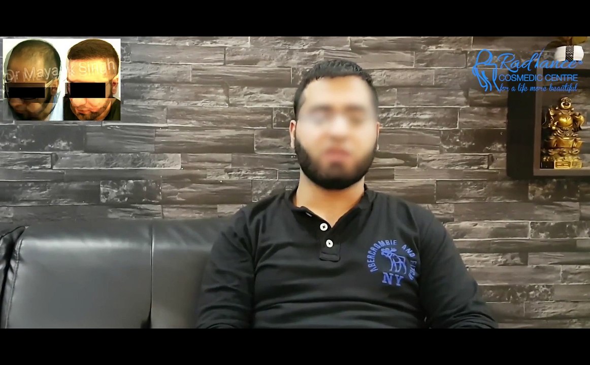 Hair Transplantation Before & After Results in Delhi INDIA by Dr. Mayank Singh