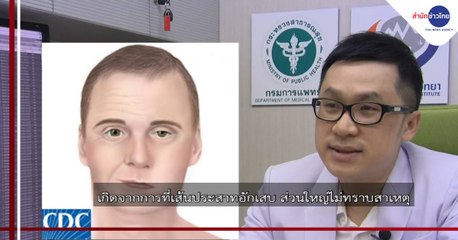 ชัวร์ก่อนแชร์ FACTSHEET : กดนวดแก้มหรือขมับ ทำให้ปากเบี้ยวได้ จริงหรือ?